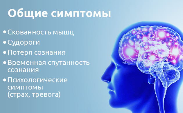 Симптомы эпилепсии