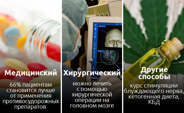 Методы лечения эпилепсии