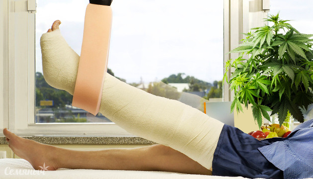 Помощь ГГК при лечении переломов